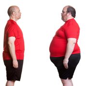 Arthrose : perdre du poids pour souffrir moins