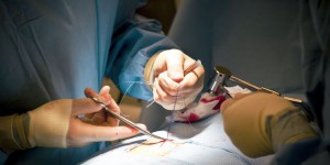 Mal de dos: la chirurgie, option à ne pas négliger