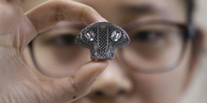 Impression 3D : une vertèbre a été implantée chez un jeune Chinois