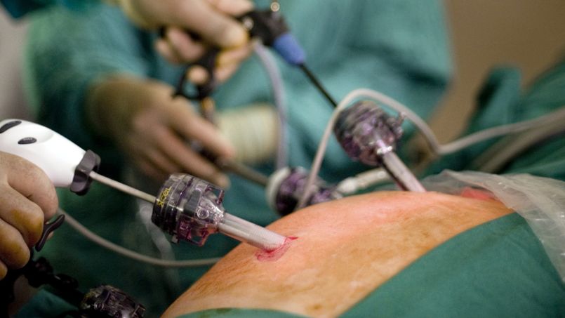 Cancer du rein: quelle révolution avec la chirurgie conservatrice ?