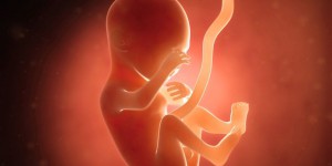 Première française dans l'opération in utero d'une malformation congénitale