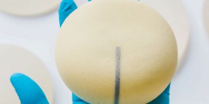 La France renonce à évaluer les effets indésirables des prothèses mammaires