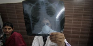 Une voyageuse atteinte de tuberculose multirésistante sème la panique