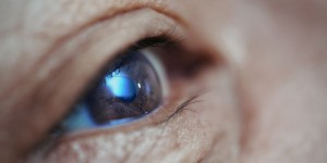 La cataracte ne concerne pas seulement les seniors