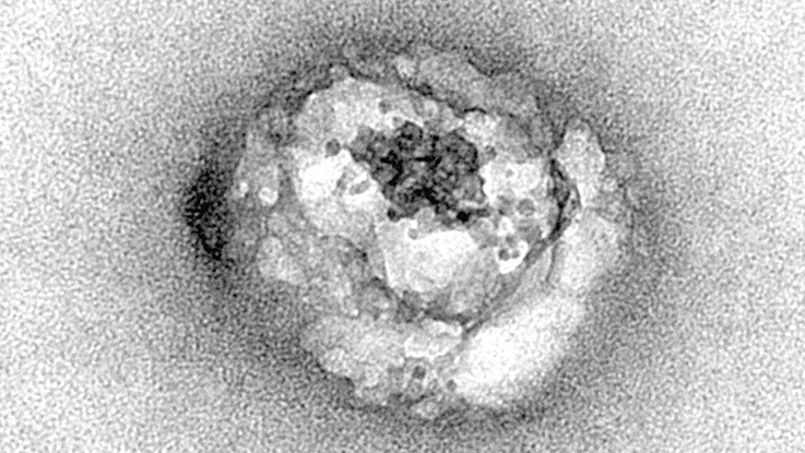 Des Français observent le virus de l'hépatite C, une première mondiale