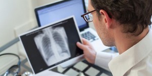 L'immunothérapie bouleverse la prise en charge du cancer avancé du poumon