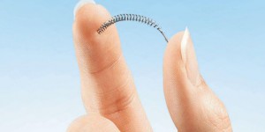 Stérilisation : les implants Essure dans la tourmente