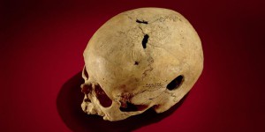 Les hommes préhistoriques déjà très férus de médecine