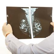 Dépistage du cancer du sein : deux consultations proposées à 25 et 50 ans 