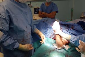 Réimplantation des deux bras après un accident, une première en France