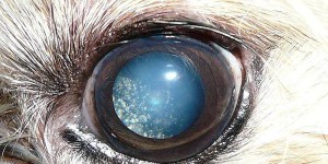 Une maladie oculaire dépose des paillettes dans les yeux
