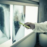 Une femme meurt d’un cancer après avoir reçu les poumons d’une fumeuse