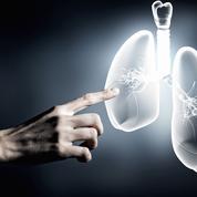 Transplantation: nouvel avenir pour la greffe de poumons