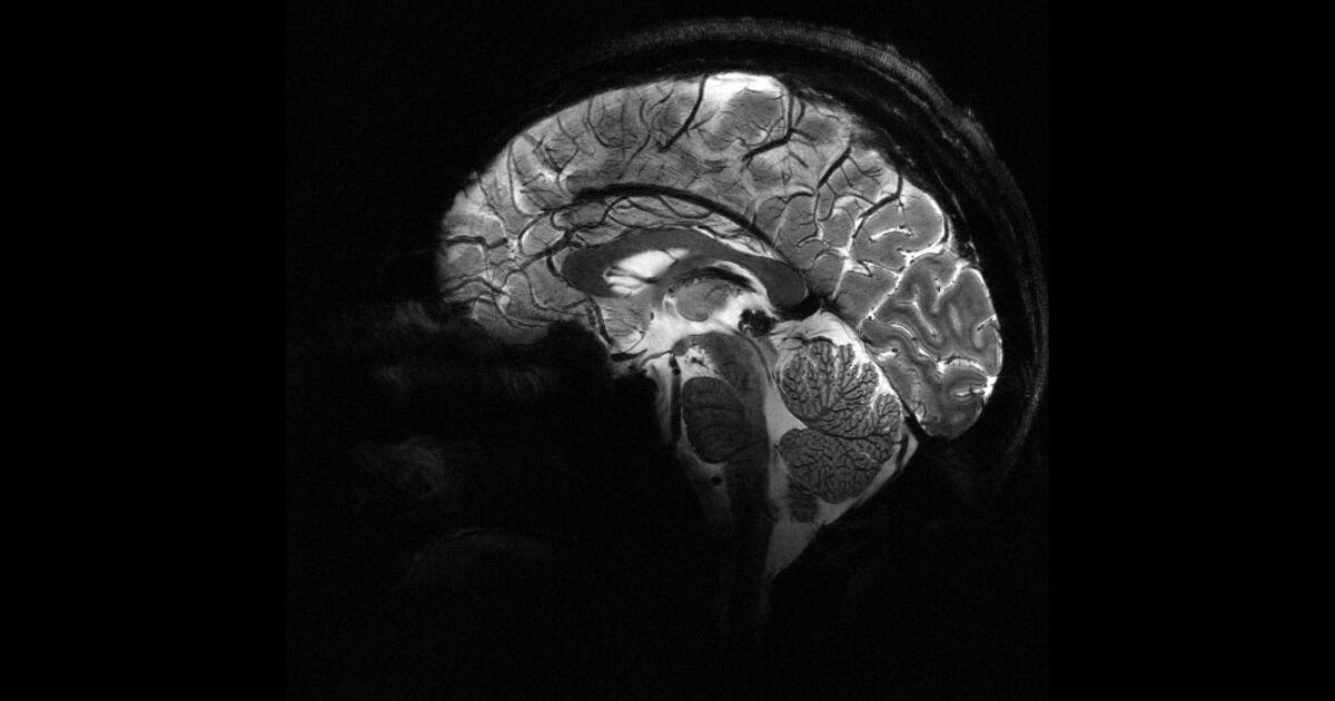 L'IRM la plus puissante du monde livre ses premières images de cerveau