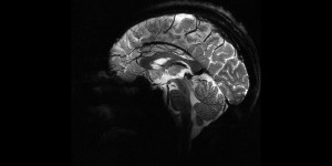 L'IRM la plus puissante du monde livre ses premières images de cerveau