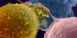 Une enzyme récemment isolée pourrait être le point faible du VIH