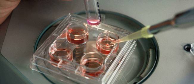 Des cellules souches embryonnaires d'individus adultes obtenues par clonage