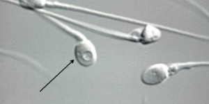 Des spermatozoïdes humains in vitro pour lutter contre l'infertilité
