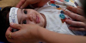 Comment Zika induit la microcéphalie chez les nourrissons