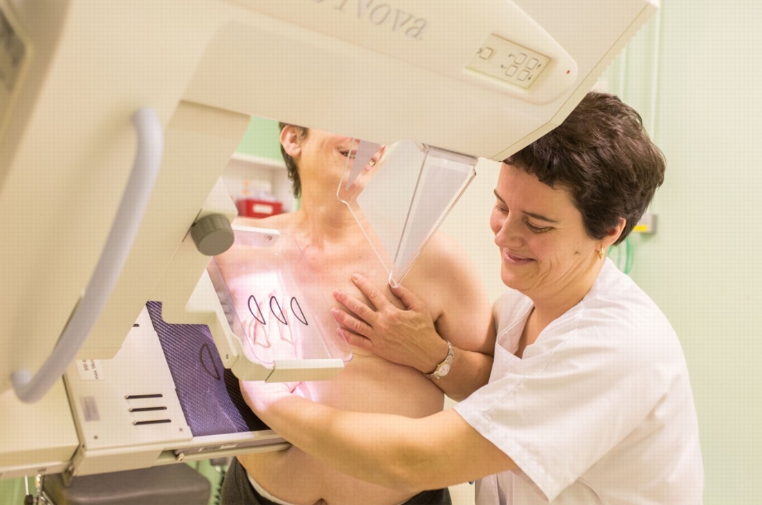 Cancer du sein : une double mastectomie rarement nécessaire