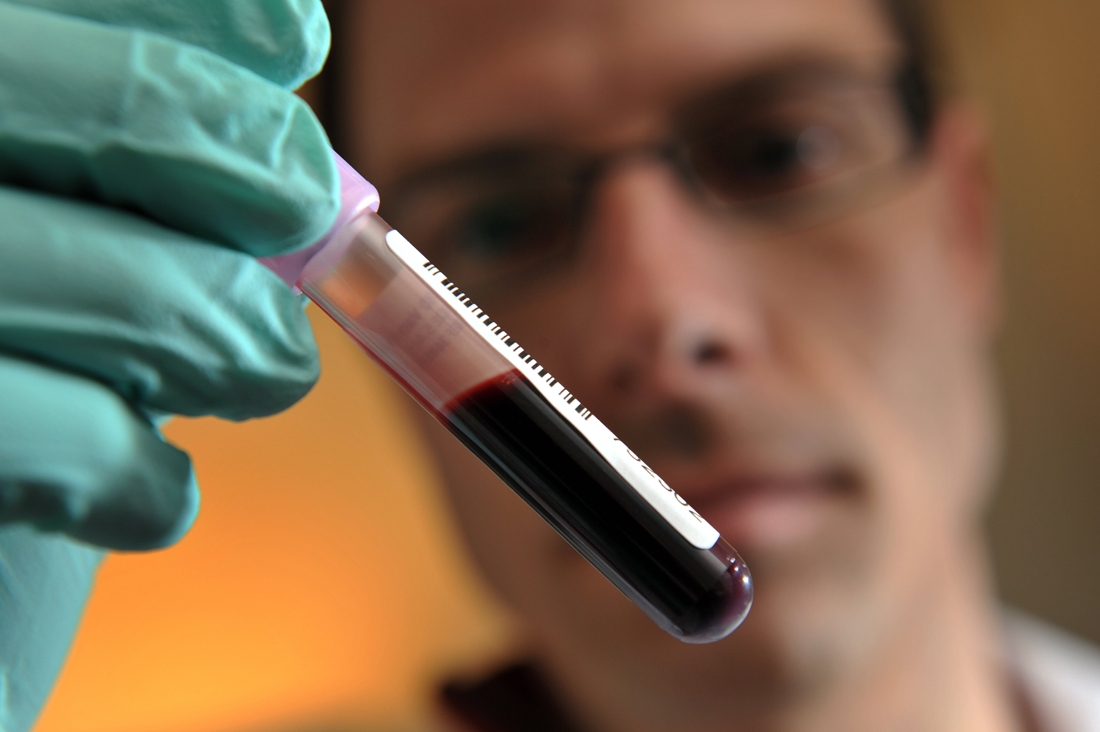 Des chercheurs mettent au point une cure magnétique pour nettoyer le sang