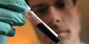 Des chercheurs mettent au point une cure magnétique pour nettoyer le sang