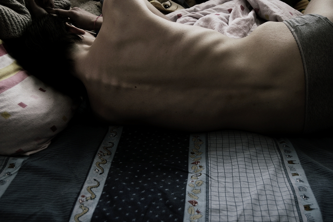 France : l’incitation à l’anorexie punissable d’un an de prison et 10.000 euros d’amende 