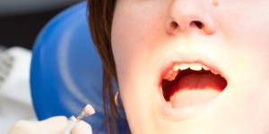 L’image de l’arracheur de dents a la… dent dure 