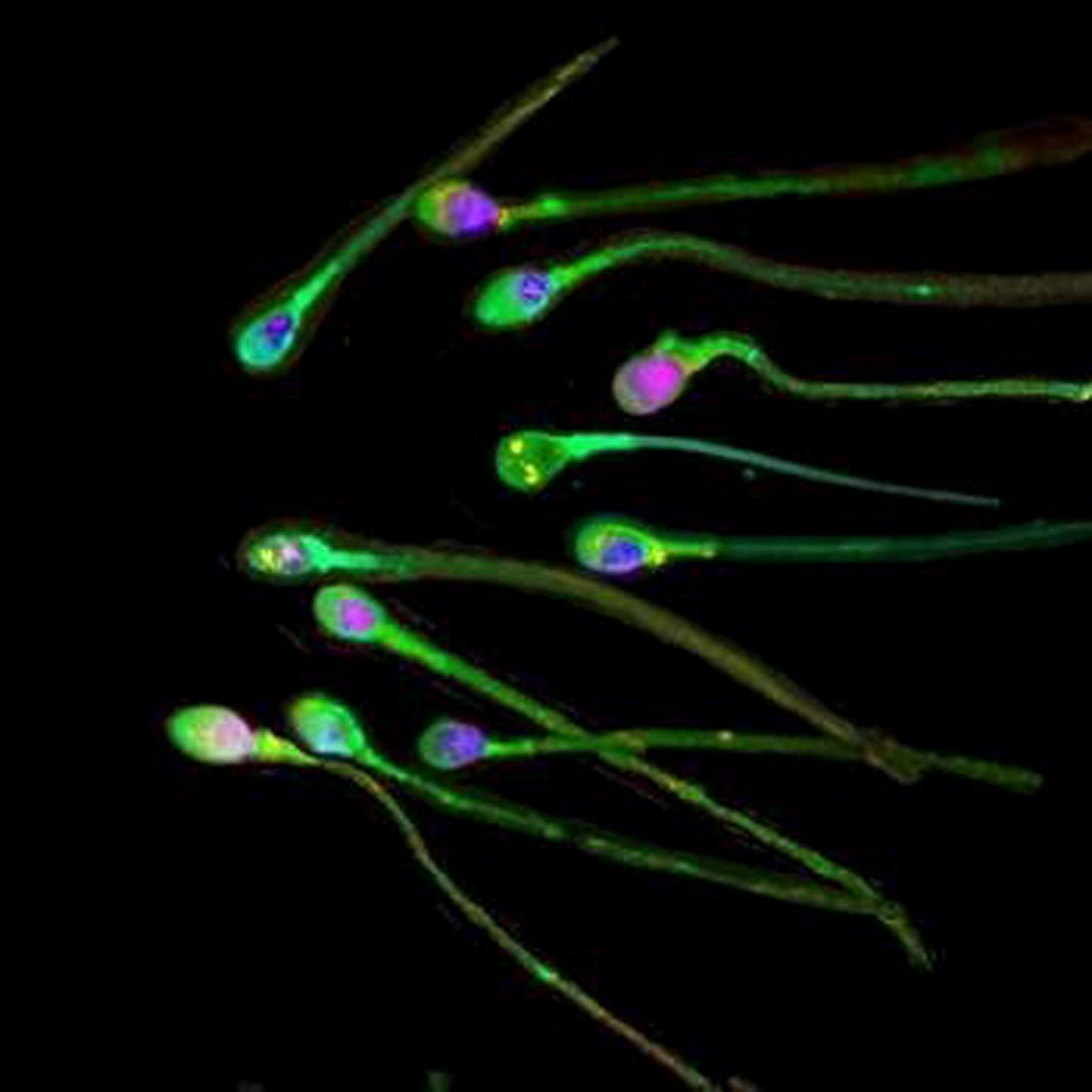 Des spermatozoïdes in vitro qui pourraient révolutionner l’infertilité masculine 