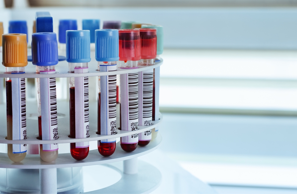 Infarctus : un nouveau test sanguin pour identifier les patients à très faible risque 