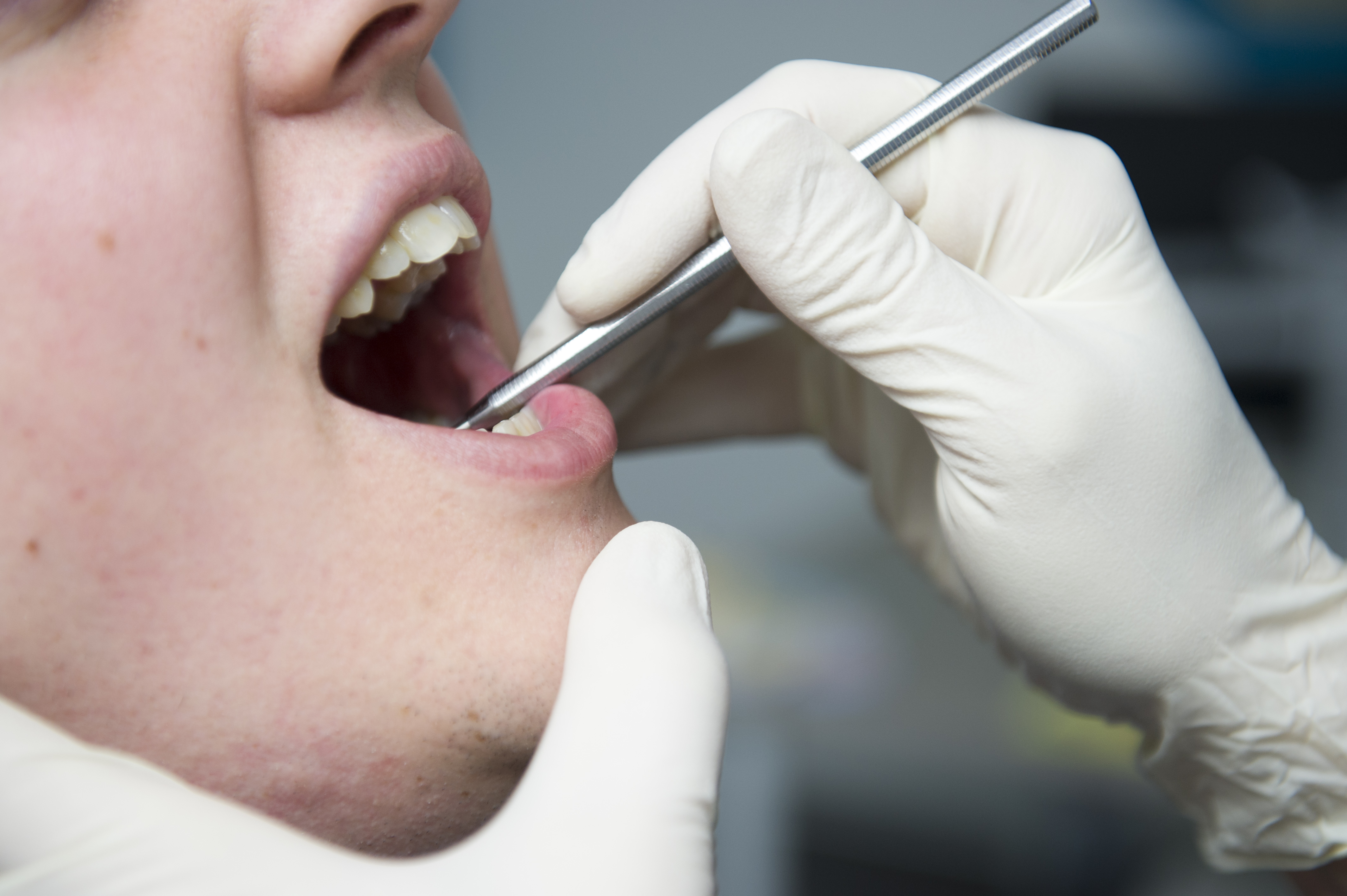 Un accord dentistes-mutualités «positif pour les patients et les dentistes» 