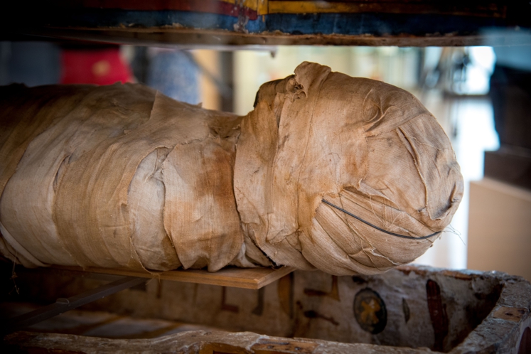 VIDÉO | La momie du musée du Cinquantenaire avait des abcès dentaires 