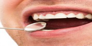 Pourquoi il ne faut pas négliger les infections bucco-dentaires