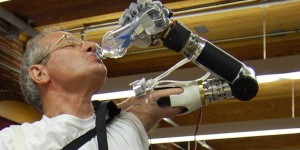 Des bras bioniques de plus en plus performants