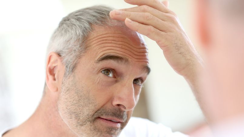 Prostate: le cancer plus agressif chez certains chauves