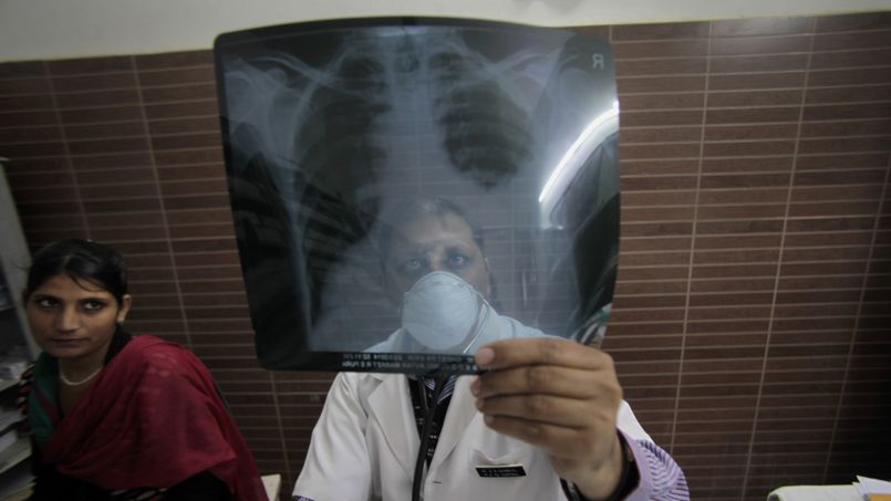 Une voyageuse atteinte de tuberculose multirésistante sème la panique