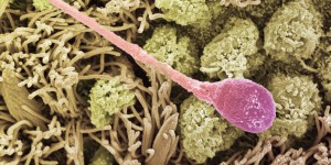 Spermatozoïdes artificiels: encore beaucoup d'obstacles