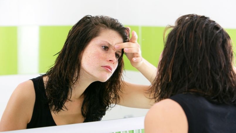 Traitements contre l'acné : les nouvelles recommandations