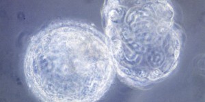 Des manipulations génétiques sur des embryons humains autorisées en Grande-Bretagne