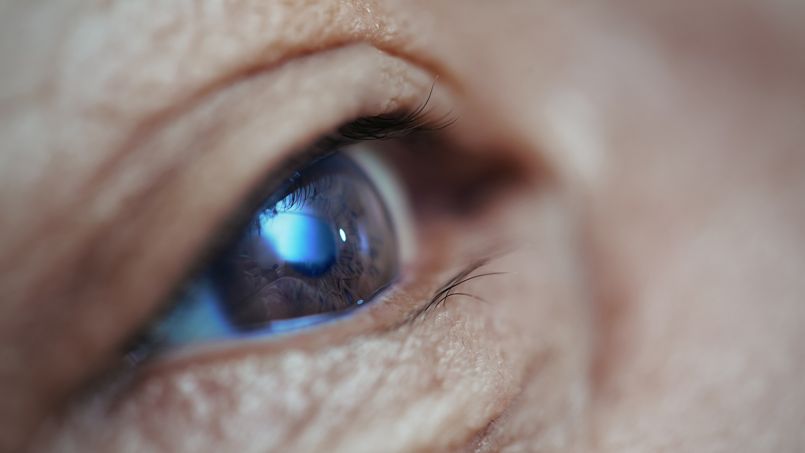 La cataracte ne concerne pas seulement les seniors