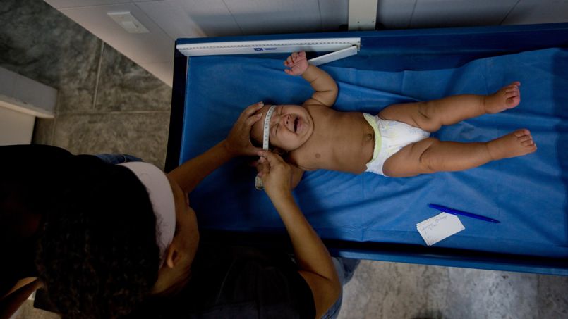 Zika: première naissance d'un bébé microcéphale en Europe