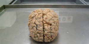 La Belgique reçoit une collection rarissime de cerveaux