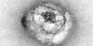 Des Français observent le virus de l'hépatite C, une première mondiale