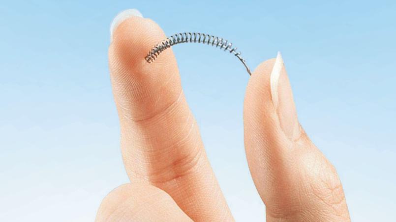 Stérilisation : les implants Essure dans la tourmente