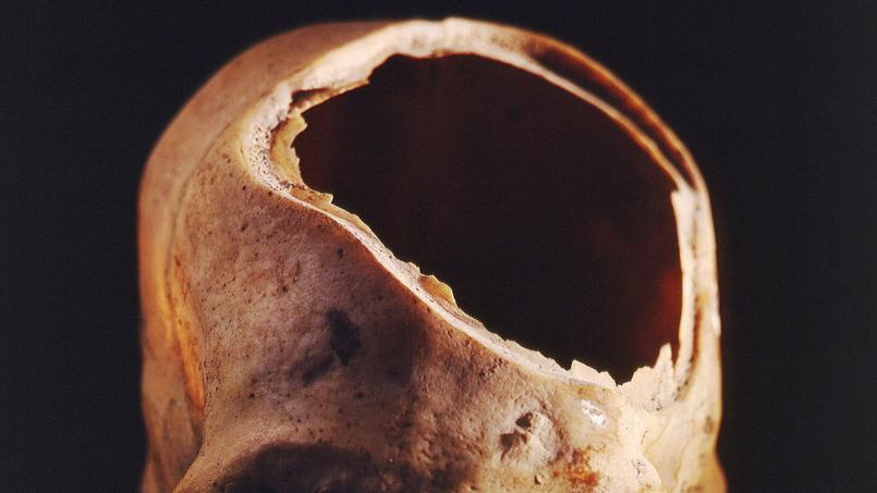 Des outils modernes pour comprendre la médecine préhistorique