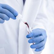 Dépistage de la trisomie 21: la HAS recommande le test sanguin