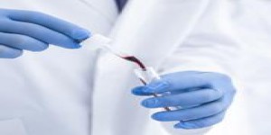 Dépistage de la trisomie 21: la HAS recommande le test sanguin