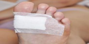 Plaie du pied du diabétique : un pansement améliore la cicatrisation
