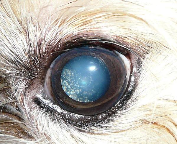 Une maladie oculaire dépose des paillettes dans les yeux