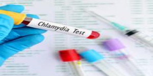 Chlamydia: les autorités de santé plaident pour un dépistage des jeunes femmes